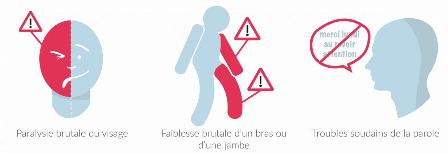 Guide Retour à domicile des seniors après un AVC Blog Tous ergo